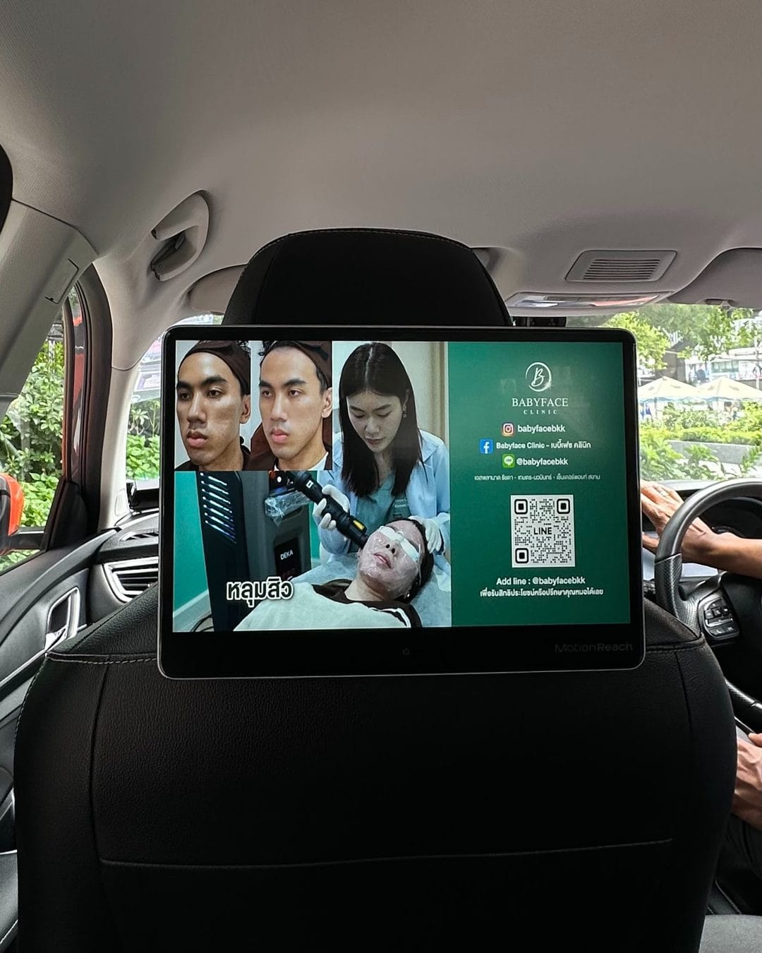 Babyface Clinic acne-treatment ad with LINE QR code on a MotionReach taxi headrest screen